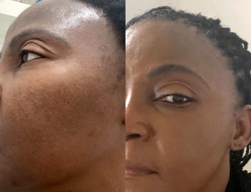 labelshopper Advanced Skin Brightening Cream – Dark Spot Corrector - Image 9